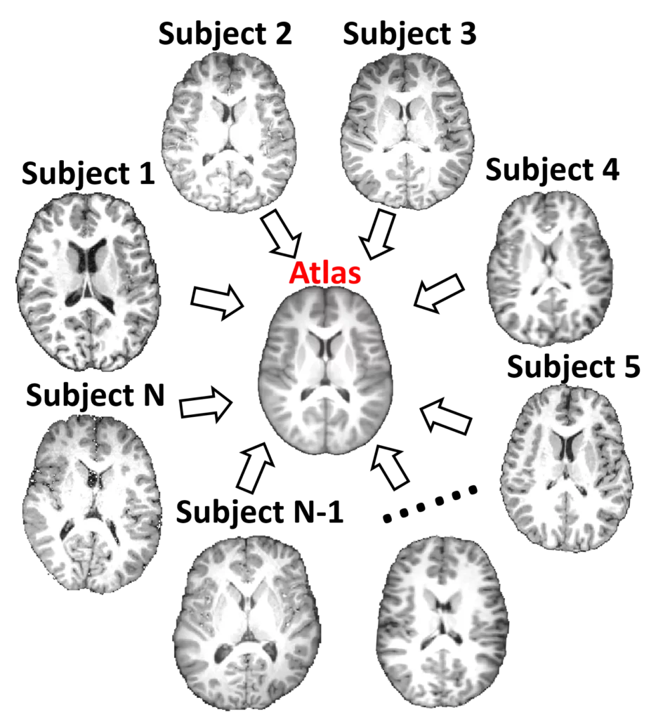 Algorithm development in BCH for the brain atlas